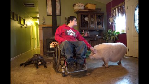 Derek Longwell, 20, has spina bifida, hydrocephalus, a neurogenic bowel and bladder, and bi-lateral clubbed feet. He and his family live in on a farm in Shingletown, California, with nearly 100 farm animals and pets. Derek has had 42 surgeries in his life.