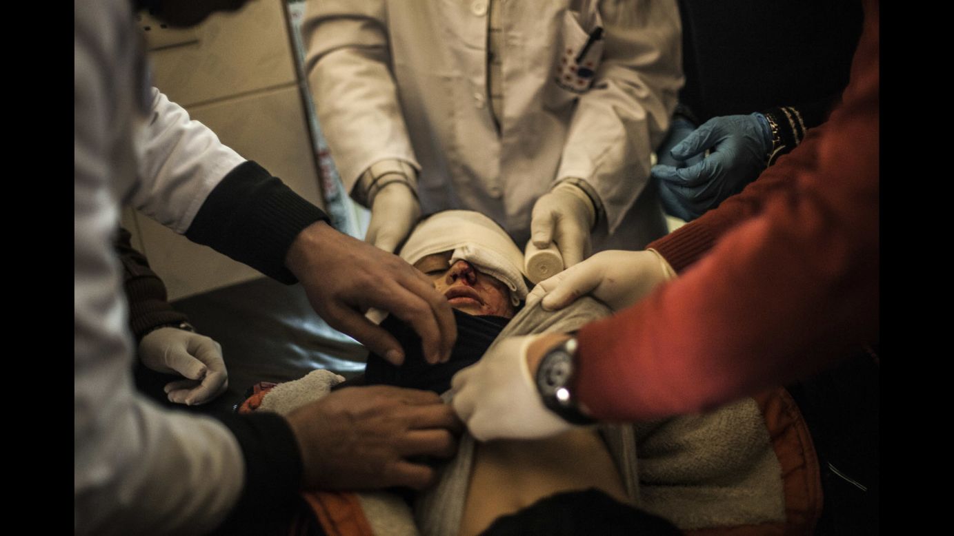Yousuf Odey, 10, receives treatment at a clinic in Mosul, Iraq, on Wednesday, December 7, after being wounded in the eye by Islamic State militants. An offensive <a href="http://www.cnn.com/2016/10/17/world/gallery/mosul/index.html" target="_blank">began in October</a> to reclaim Mosul, Iraq's second-largest city and the last major stronghold for ISIS in the country.