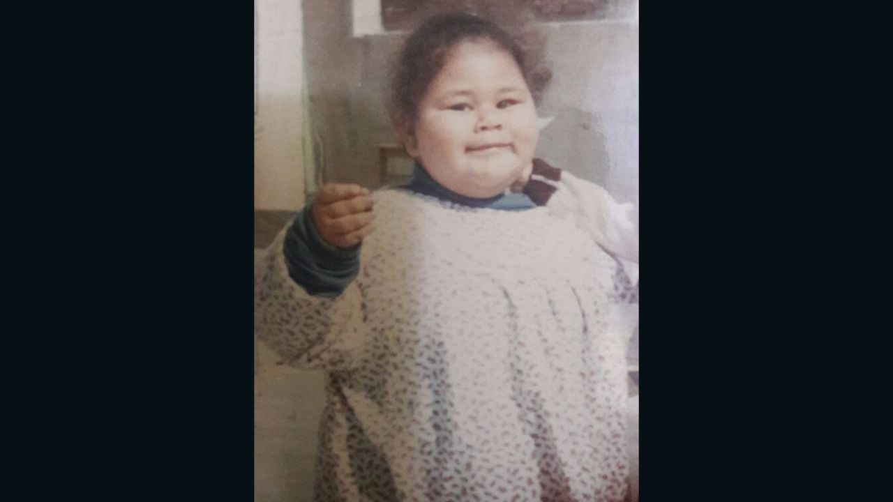 As a young girl Eman had to start using her knees to move around.