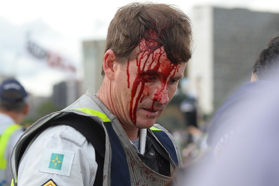 A police officer is seen with an injury during clashes with protesters  in Brasilia on December 13.