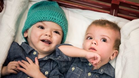 Anias, left, and Jadon lie in a red wagon at the Children's Hospital at Montefiore Medical Center on December 13 as they prepare for the next stage of their journey, two months after their surgery.