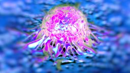 Prostate cancer cells. Researchers in Australia say that they have developed a new test for cancer that can provide an accurate detection in under ten minutes. 