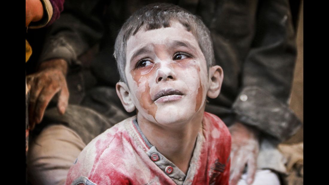A wounded Syrian boy cries after bombs fell on the opposition-controlled Firdevs neighborhood in Aleppo on October 11, 2016.