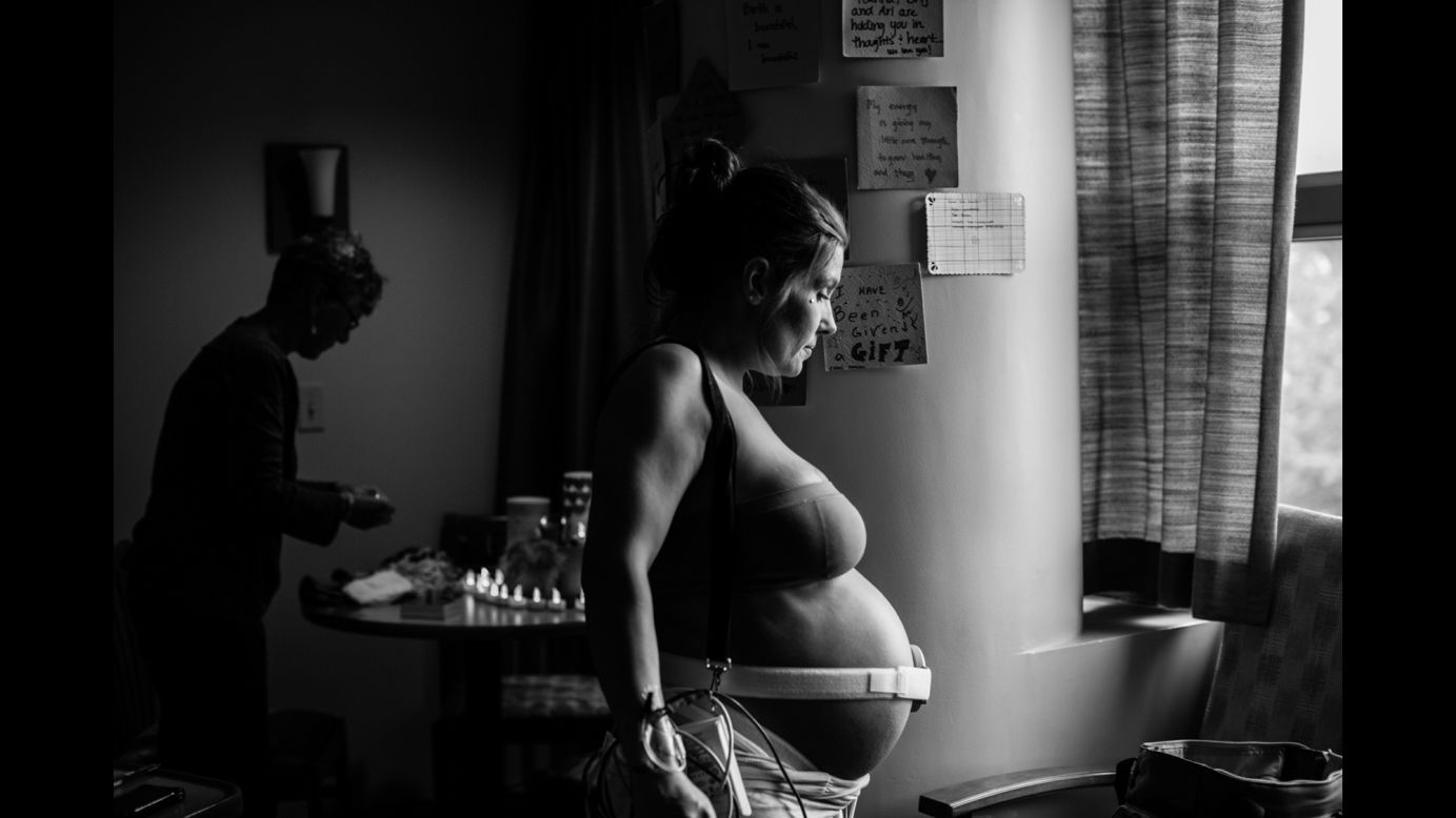 Jennifer Allison breathes through a contraction before giving birth to her daughter Sky 19 months ago. Sky was born with heterotaxy, a series of rare birth defects, and doctors warned that she might not make it past her toddler years. Allison wanted to "carry Sky as far as she wanted to go," said photographer Ash Adams, who has been documenting the family's struggle since Sky's birth.
