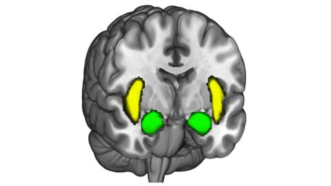 The amygdala -- the two almond-shaped areas hugging the center of the brain near the front -- tends to become active when people stick to their political beliefs, according to the new study.