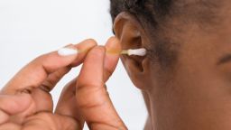 earwax guidelines