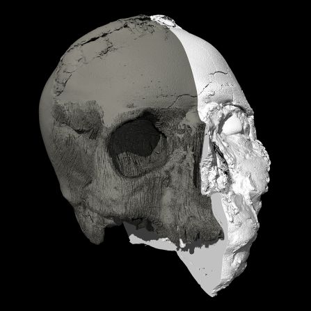 Micro-CT scanning was used to extract a model of the skull from underneath the plaster face