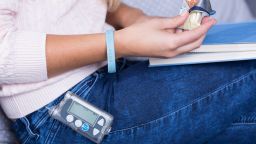 Diabetic woman with an insulin pump holding a sweet snack.