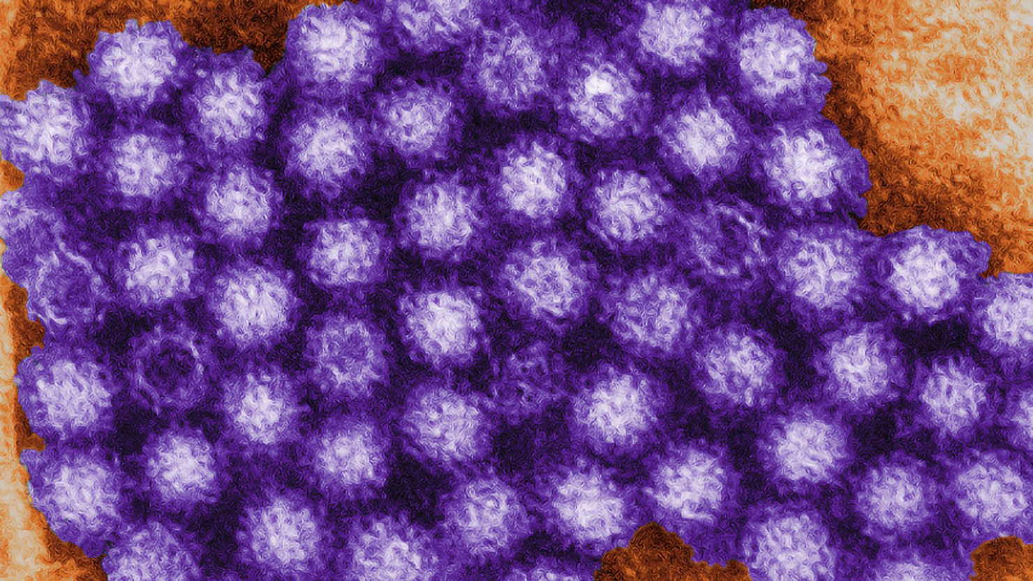 Noroviruses are a group of viruses that cause gastroenteritis.