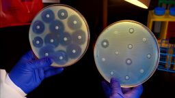 Bacteria resistant to antibiotics is are killing thousands in Europe each year. 