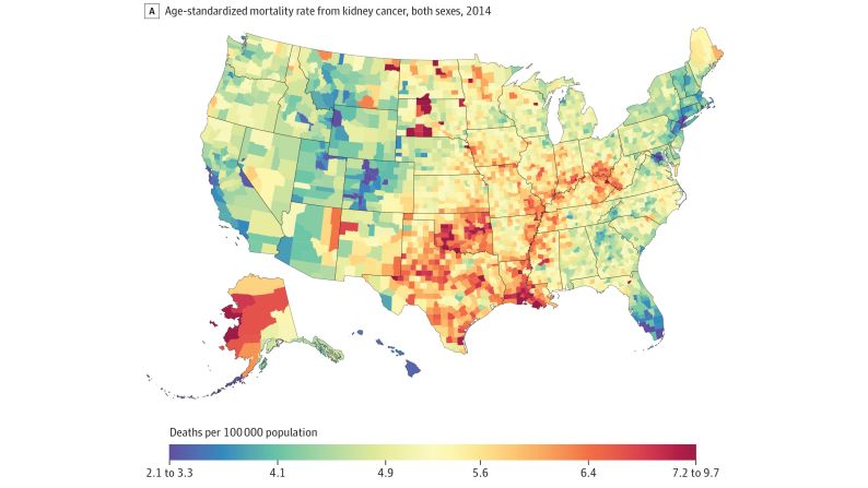 Deaths from kidney cancer in 2014 were highest in Alaska, Texas, Louisiana, Oklahoma and the Dakotas. Deaths were lowest in parts of Florida and Colorado.