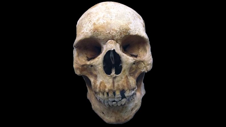 By studying the skeleton of this medieval pilgrim, researchers have been able to <a href="index.php?page=&url=http%3A%2F%2Fwww.cnn.com%2F2017%2F01%2F26%2Fhealth%2Fleprosy-medieval-pilgrim-skeleton-study%2Findex.html">genotype leprosy</a>. They also discovered that leprosy-causing bacteria have changed little over hundreds of years, possibly explaining the decline in the disease after it peaked in medieval Europe as humans developed resistance.
