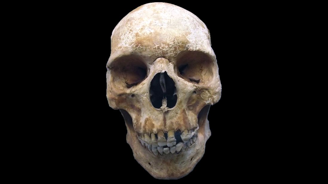 By studying the skeleton of this medieval pilgrim, researchers have been able to <a href="http://www.cnn.com/2017/01/26/health/leprosy-medieval-pilgrim-skeleton-study/index.html">genotype leprosy</a>. They also discovered that leprosy-causing bacteria have changed little over hundreds of years, possibly explaining the decline in the disease after it peaked in medieval Europe as humans developed resistance.