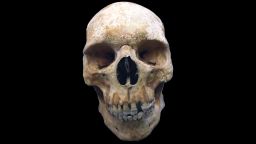 01 medieval pilgrim leprosy skeleton