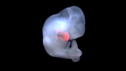 human pig embryo