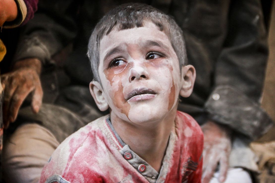 A wounded Syrian boy cries after Russian airstrikes on an Aleppo neighborhood in October 2016.