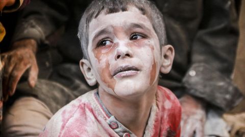 A wounded Syrian boy cries after Russian airstrikes on an Aleppo neighborhood in October 2016.