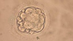 SEOUL, SOUTH KOREA - FEBUARY 12: This undated microscopic photo shows a cloned human embryo used to generate stem cells during an experiment in Seoul. South Korean researchers said they had cloned a human embryo February 12, 2004 and extracted embryonic stem cells from it. (Photo by Seoul National University/Getty Images)