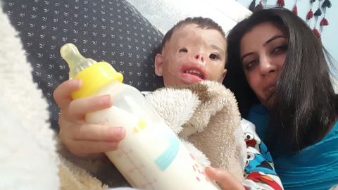 Since his first surgery, Dilbireen has been cared for by a Yazidi advocate, Adlay Kejjan, in Michigan.