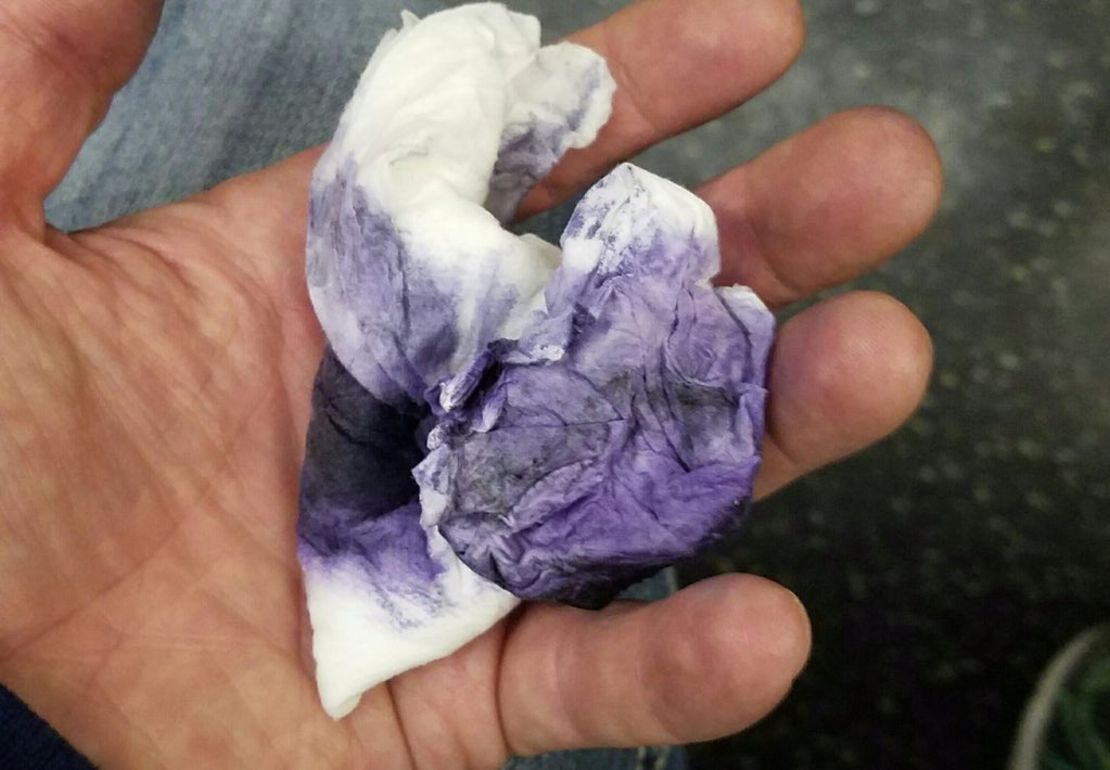 Nied shows one of the wipes he used to remove the graffiti.