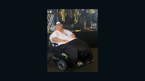 Roger Logan before his surgery.