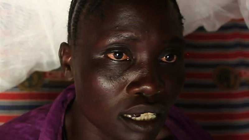 South Sudan: Famine Declared; 4.9 Million People Need Urgent Help | CNN