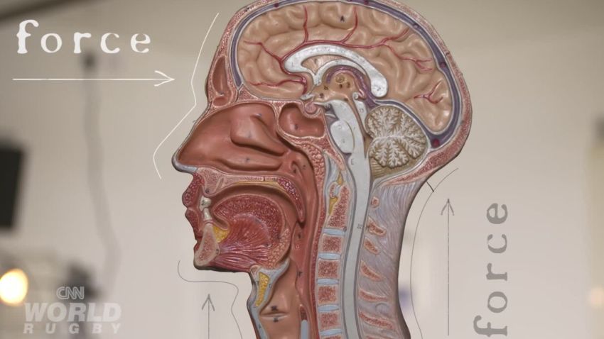 spc cnn world rugby concussion explained_00001029.jpg