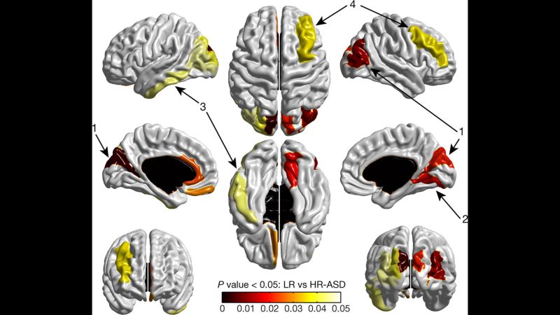 brain gym for autism