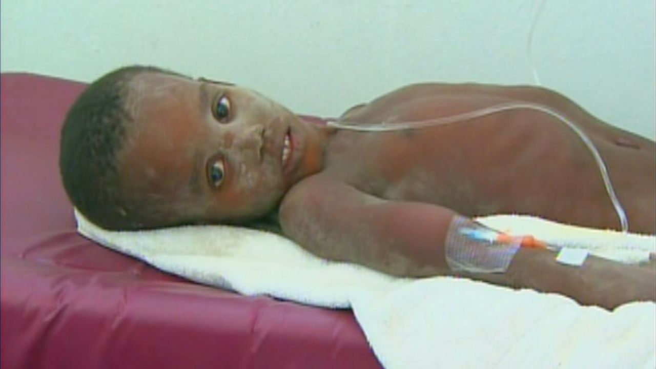 Monley Elysee, receiving urgent treatment in January 2010.