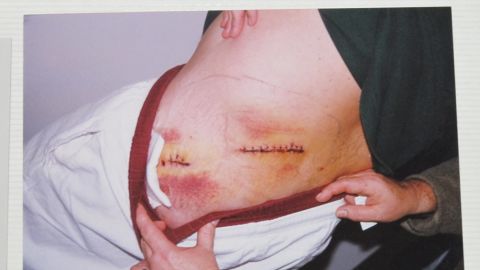 The rookie LAPD officer's wounds.