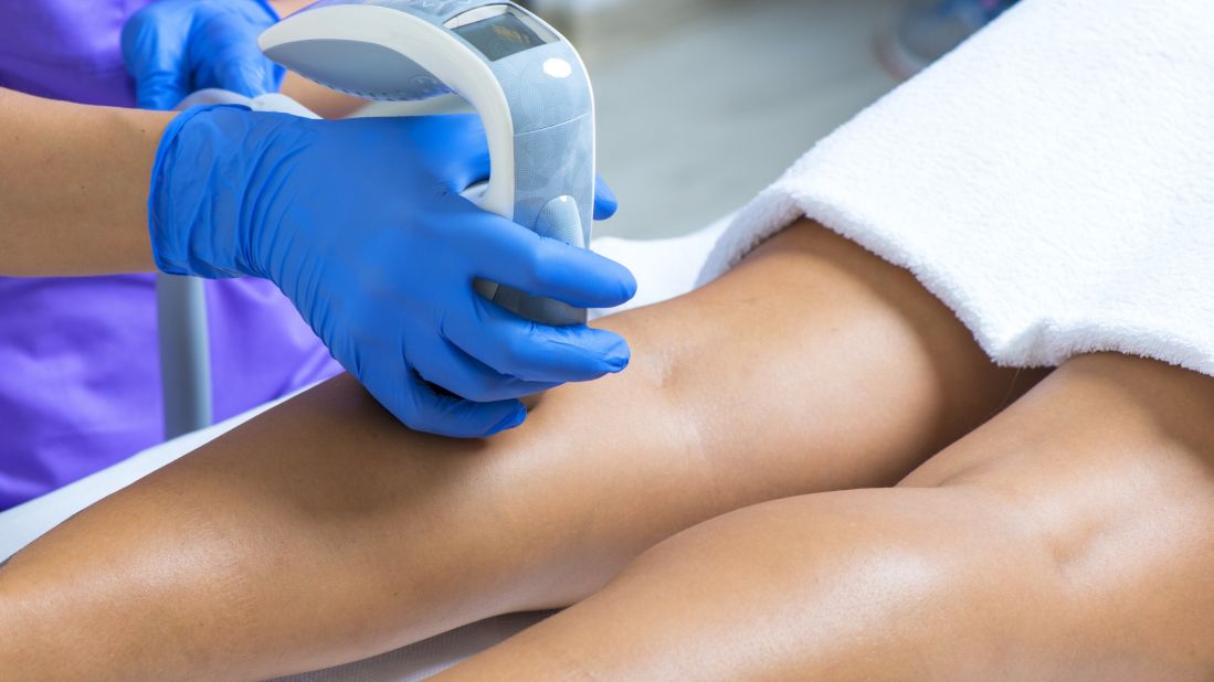 Laser hair removal, intended to remove unwanted hair from various parts of the body, was the fourth most-popular, with 1.1 million procedures.