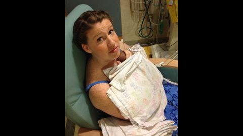 Pregnancy Almost Killed Her Should She Try Again Cnn Pregnancy Almost Killed Her Should She Try Again Cnn