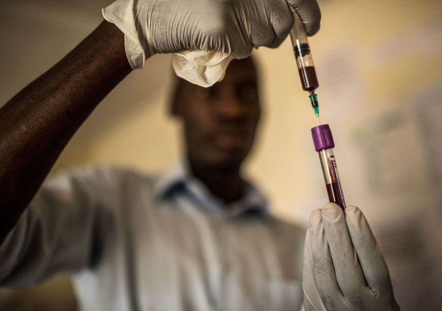 Laboratory technician Denis Bongoyinge prepares a blood sample for an STI test at the RHU clinic in Gulu, Uganda. 