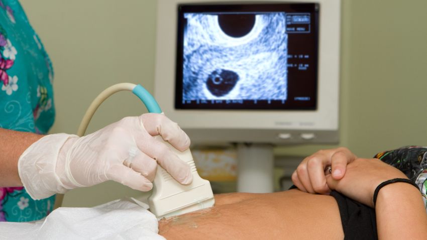 ultrasound pregnancy