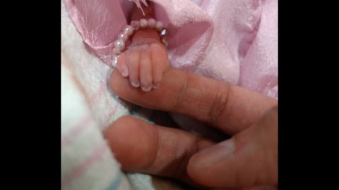 Pregnancy Almost Killed Her Should She Try Again Cnn Pregnancy Almost Killed Her Should She Try Again Cnn