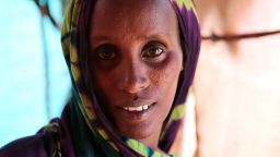 Fatuma Hassan Hussein is tired and gaunt. She says she travelled more than a hundred miles to get to a camp in Baidoa, Somalia. 
