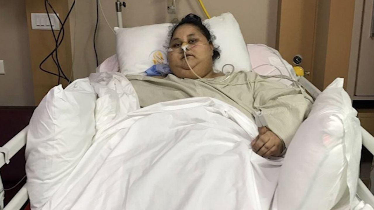 Eman Ahmed World's heaviest Woman Surgery