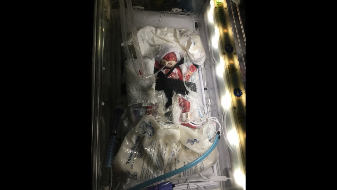 Baby Beckham in the neonatal intensive care unit.