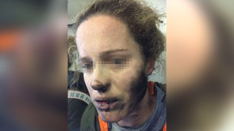 A passenger on an international flight, pictured, said her headphones caught on fire midflight.