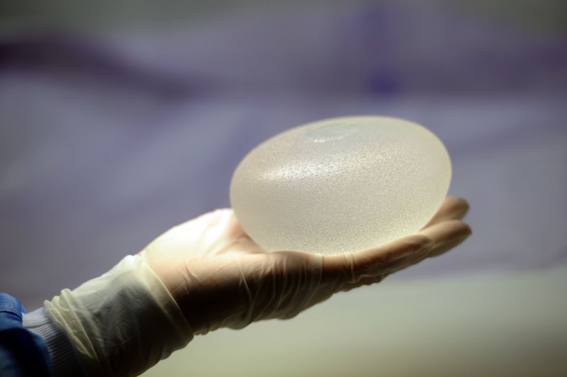 Cancer deaths linked to breast implants