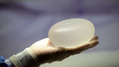 Women with breast implants have an increased risk of developing anaplastic large cell lymphoma. 