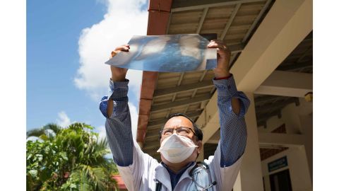 Dr. Chhim, a physician at Kampong Cham hospital, Cambodia, examines a TB patients X-ray.