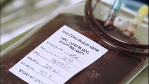 Blood extracted from an umbilical cord at University College London Hospital in March. It can be used to treat more than 80 conditions, including leukemia.