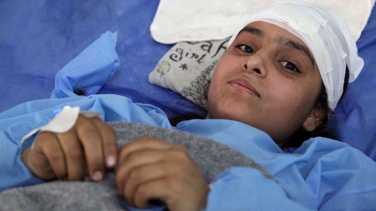 16-year-old Fatima lies in a bed at a the same Erbil hospital with a broken back. She was injured in an airstrike in the last two weeks though she doesn't recall specifically which. She only remembers being pulled out of the rubble afterwards.