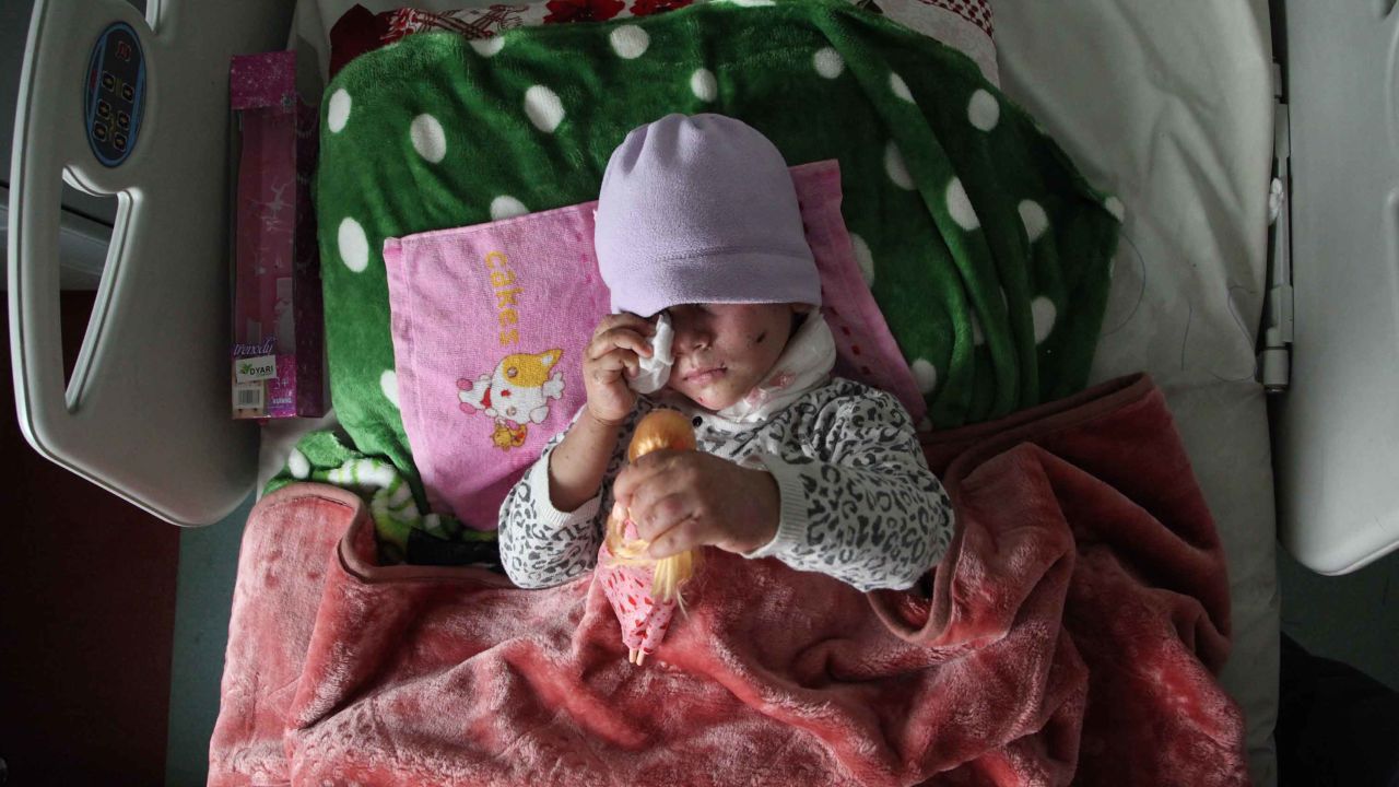 In one of the March 17 airstrikes, Hawra' suffered a broken leg and shrapnel to the face and lower back. She may never see again.