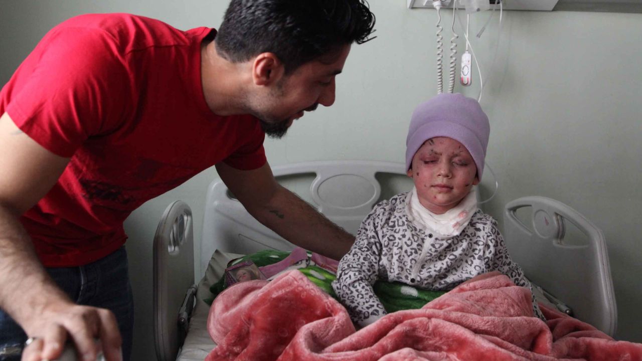 Hawra' plays with her doll while recovering in hospital. It is not yet known if she will recover her sight. She keeps asking for her mother who died in the airstrikes on March 17.