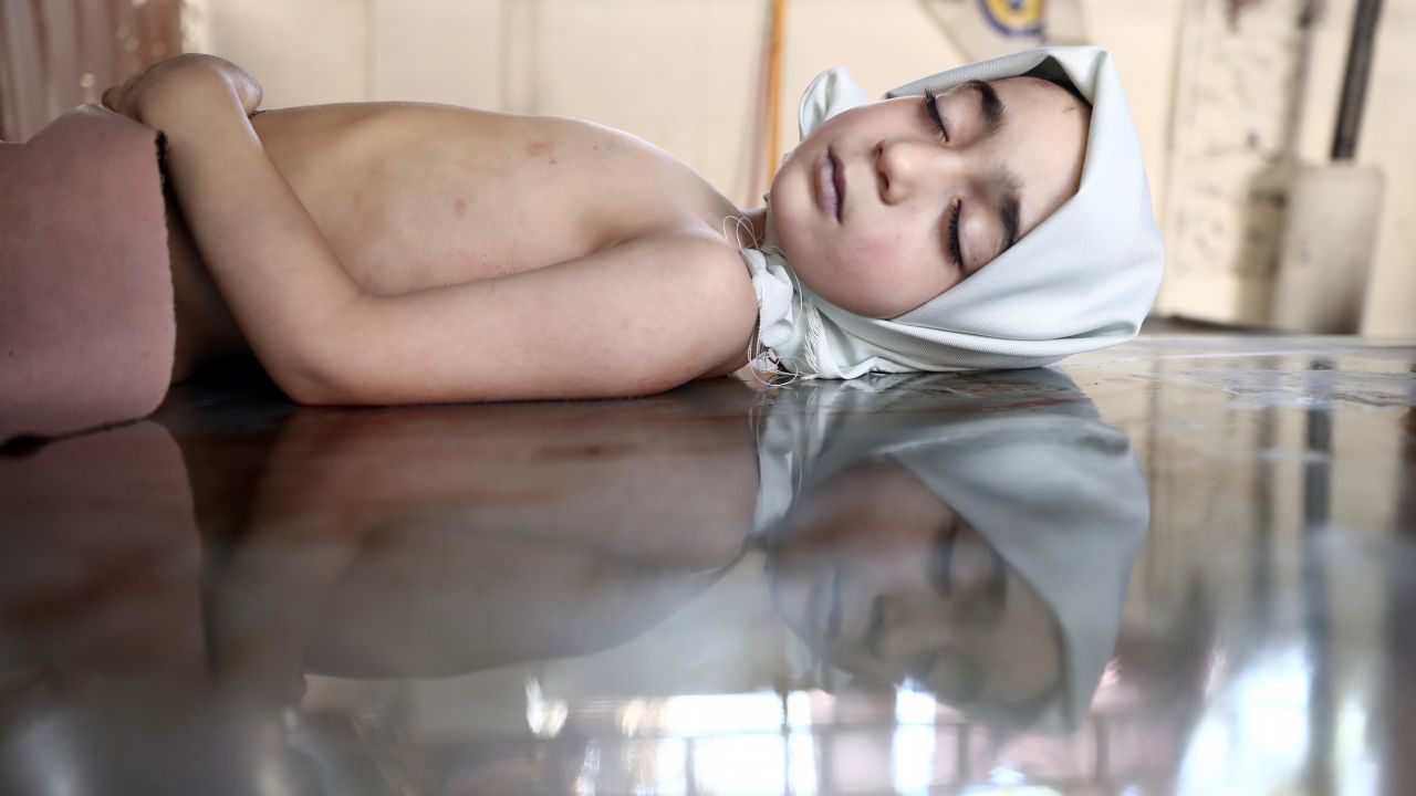 The dead body of Yousef, an 8-year-old boy, lies on a table at a morgue in Douma, Syria, on Monday, March 27. Yousef was killed by a reported airstrike in Douma, a rebel stronghold east of Damascus.
