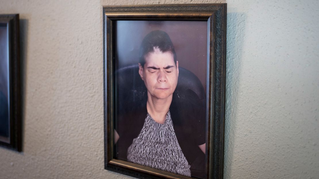 Lesli's portrait hangs on the wall at the group home where she lives.