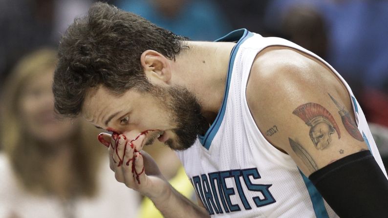 Blood flows from the face of Marco Belinelli during an NBA basketball game in Charlotte, North Carolina, on Tuesday, March 28. Belinelli had to leave the game after a collision with another player caused a cut above his right eye.