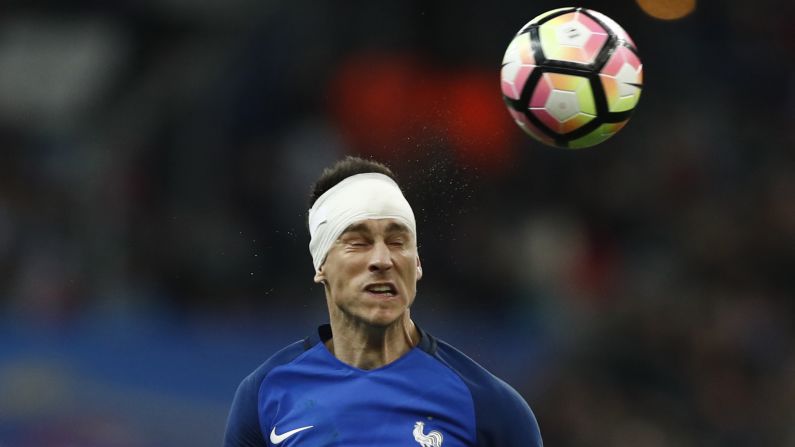 A bandaged Laurent Koscielny heads the ball for France during a friendly match against Spain on Tuesday, March 28.